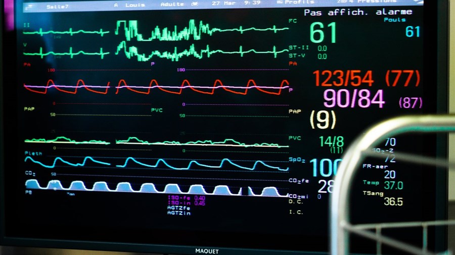 L'intelligence artificielle pourrait détecter la fibrillation auriculaire